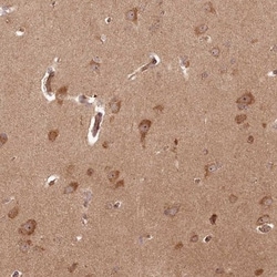 ARL3 Antibody, Novus Biologicals 0.1mL; Unlabeled:Antibodies, Polyclonal
